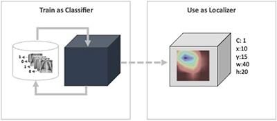 Toward explainable AI in radiology: Ensemble-CAM for effective thoracic disease localization in chest X-ray images using weak supervised learning